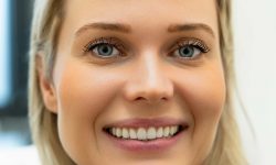 Beugels en Orthodontie